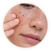 الرؤوس السوداء