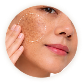 تصبغات البشرة